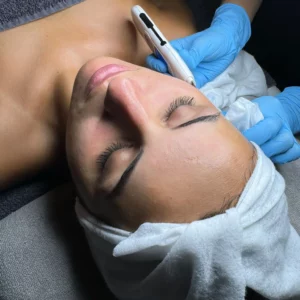 Limpieza de Cutis y Tratamientos Faciales